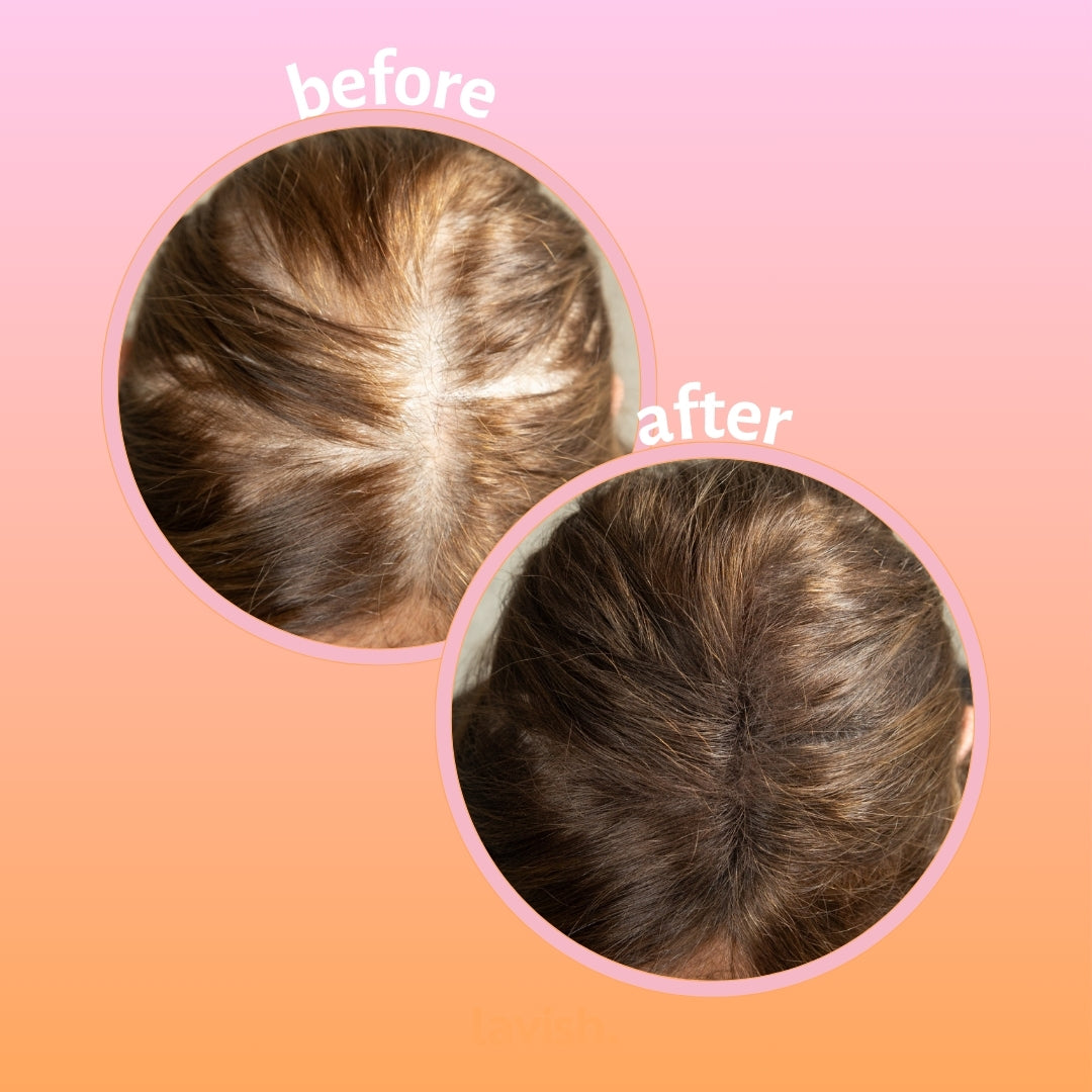 Instantly Fuller Hair